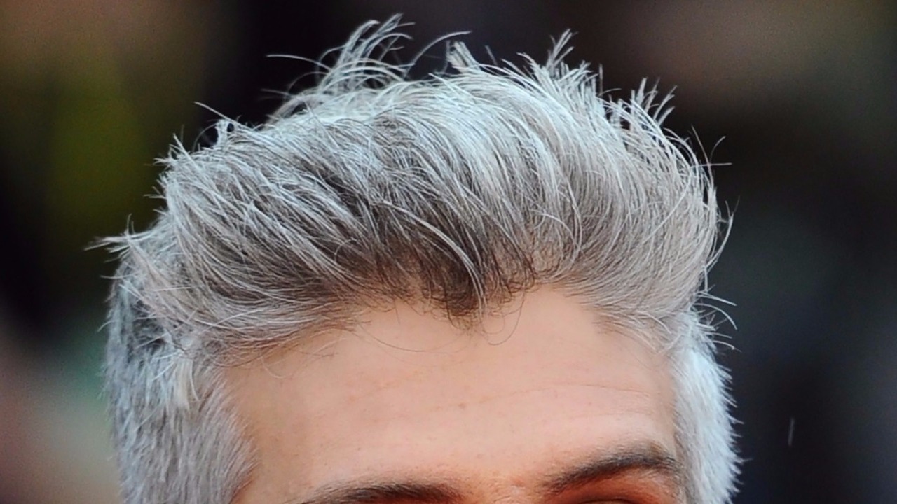 ask-dr-john-does-stress-bring-on-gray-hair-9news